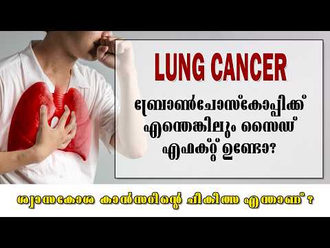 ബ്രോൺചോസ്കോപ്പിക്ക് എന്തെങ്കിലും സൈഡ് എഫക്റ്റ് ഉണ്ടോ? l Lung cancer treatments malayalam