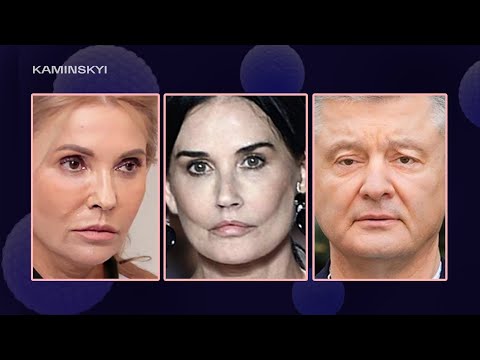 Video: Renée Zellweger, wat Botox -inspuitings verwerp het, lyk jonger