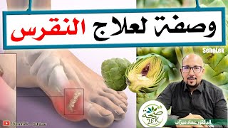 وصفة لعلاج النقرس la goutte من عند الدكتور عماد ميزاب docteur imad mizab