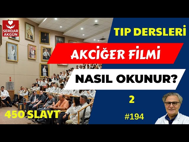 Radyoloji, Akciğer filmi nasıl okunur, 2.bölüm.  Serdar Akgün