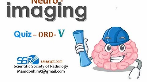 Brain imaging quiz cases (6) - Prof  Mamdouh Mahfouz