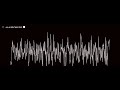 تنظيف سماعات الهاتف من الماء والغبار عن طريق ترددات 35000Hz تنظيف سماعات الهاتف من الماء والغبار عن طريق ترددات 35000Hz