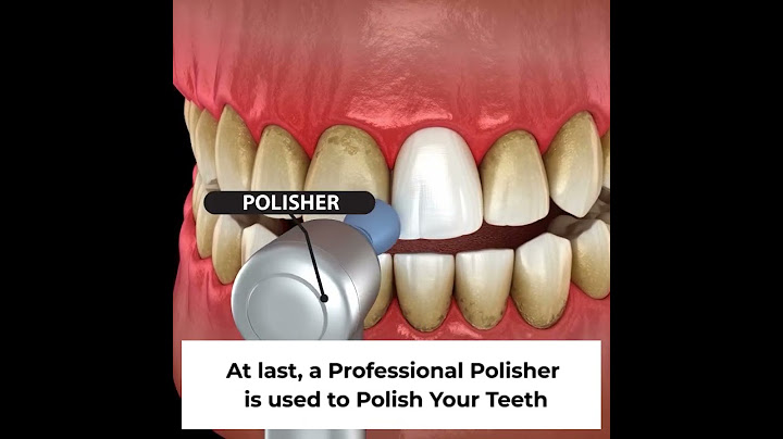 How to get Professional Teeth Cleaning at Sabka Dentist