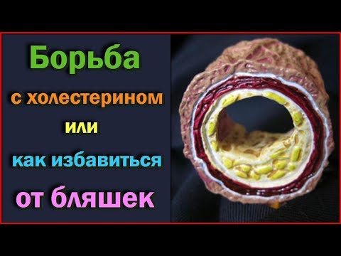 Борьба с ХОЛЕСТЕРИНОМ или 3 ПРОДУКТА чтобы просто и легко ИЗБАВИТЬСЯ ОТ БЛЯШЕК в сосудах