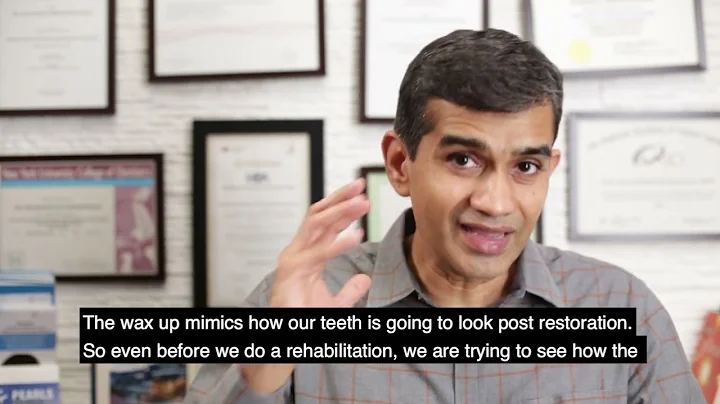 Full Mouth Rehabilitation | Dr Arunkumar Pearls Dentistry | Full Mouth Crowns Dental Clinic Chennai