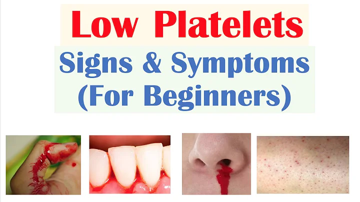 Low Platelets: Signs & Symptoms (Basics for Beginners) - DayDayNews