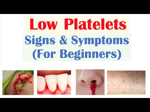 Low Platelets: Signs & Symptoms (Basics for Beginners)