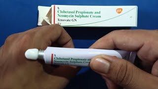 Tenovate gn cream /use fungal infection ke liy dad khaj Khujli ke best cream,skin global cream india