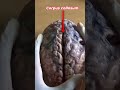 Human Brain Parts Explained #brains #science #anatomy #medicalshorts