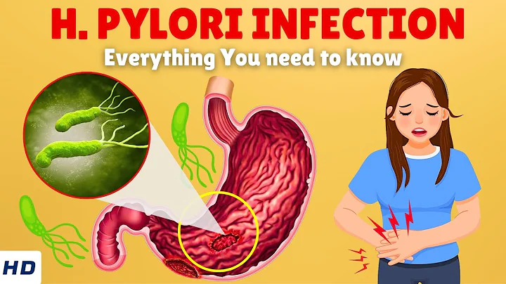 Helicobacter Pylori Infection – Causes, Signs and Symptoms, Diagnosis & Treatment