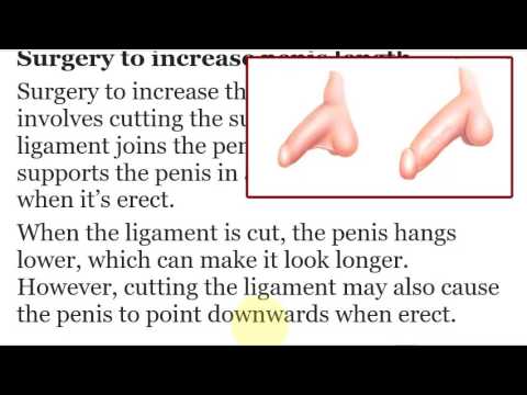 How Penis Enlargement