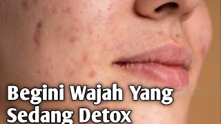 Ciri Ciri Wajah Yang Sedang Detox