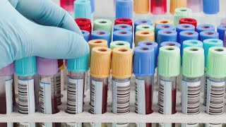 Health Matters: Will insurance companies cover blood tests for PFAS?