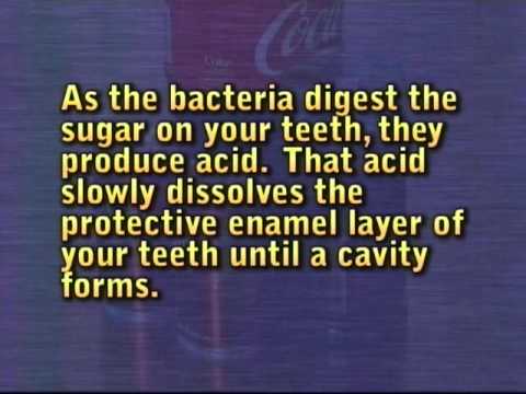 Tupelo Dentist- Dr. Richard Caron's "Your Dental Health"-Soft Drinks