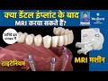 क्या डेंटल इम्प्लांट के बाद MRI करवा सकते हैं ? BEST  DENTAL IMPLANT CENTER IN INDIA YOUDENT JAIPUR