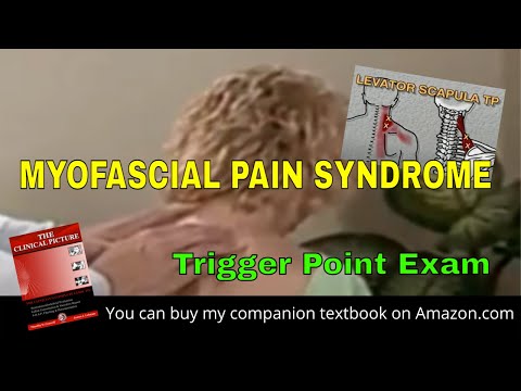Myofascial Pain Syndrome -Trigger Point Exam