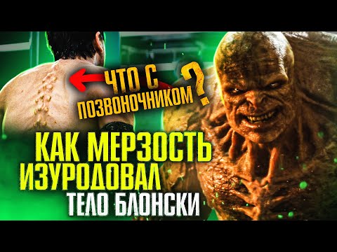 Видео: Как Мерзость изуродовал тело Эмиля Блонски