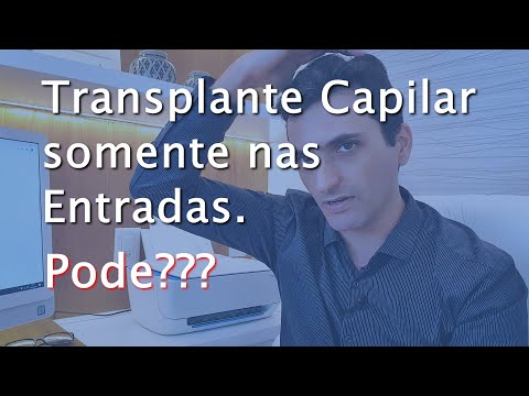 Transplante Capilar Somente