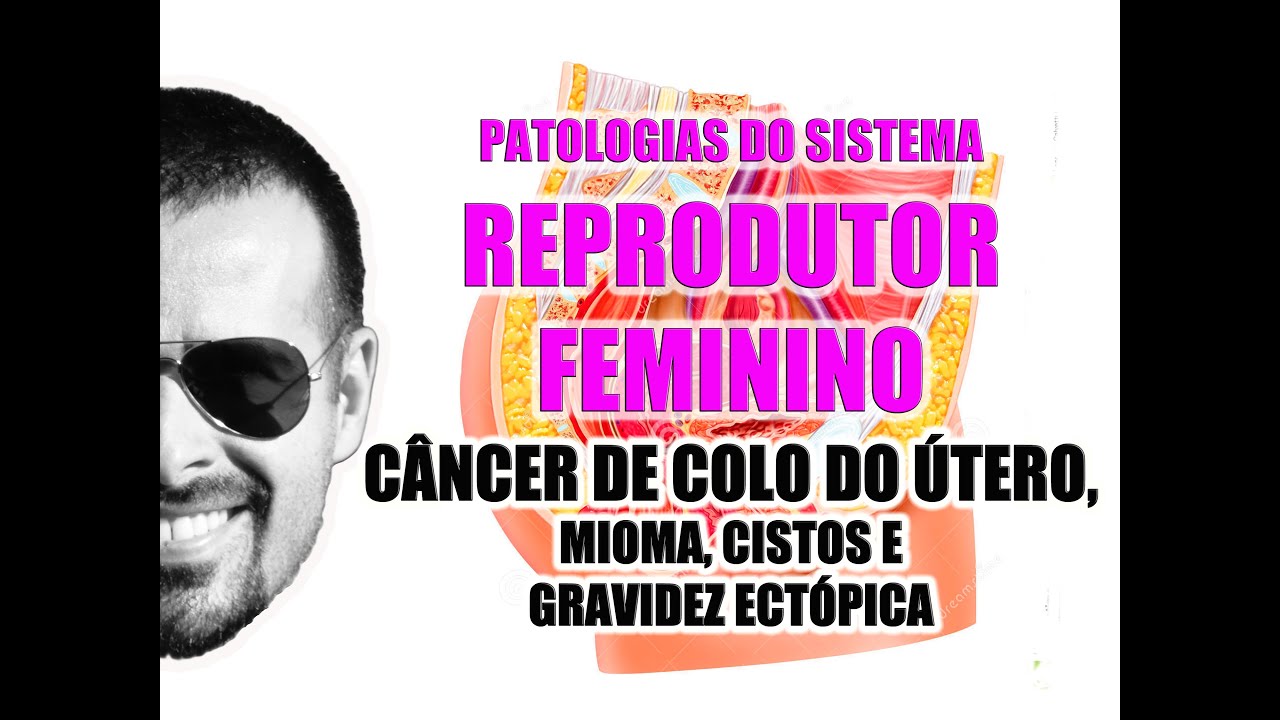 Aula de Patologia do Sistema Genital Feminino