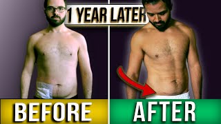 Famous My Appendix Burst & WASNT REMOVED | Story, Recovery & Your Q's Answered! Profile