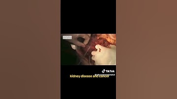 VEGAN PROVES TED NUGENT LIED ON THE JOE ROGAN POSCAST