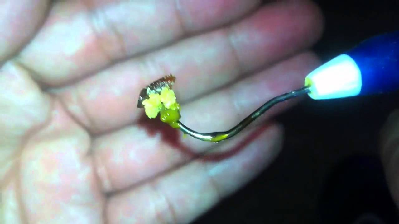 Dab sesh k.o. Titanium nail