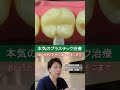 歯医者の技術差がこんなに出る？プラスチック詰め物の真実★#虫歯治療 #白い詰め物 #CR #保険治療 #自費治療 #技術 #歯科医 #白い被せ物