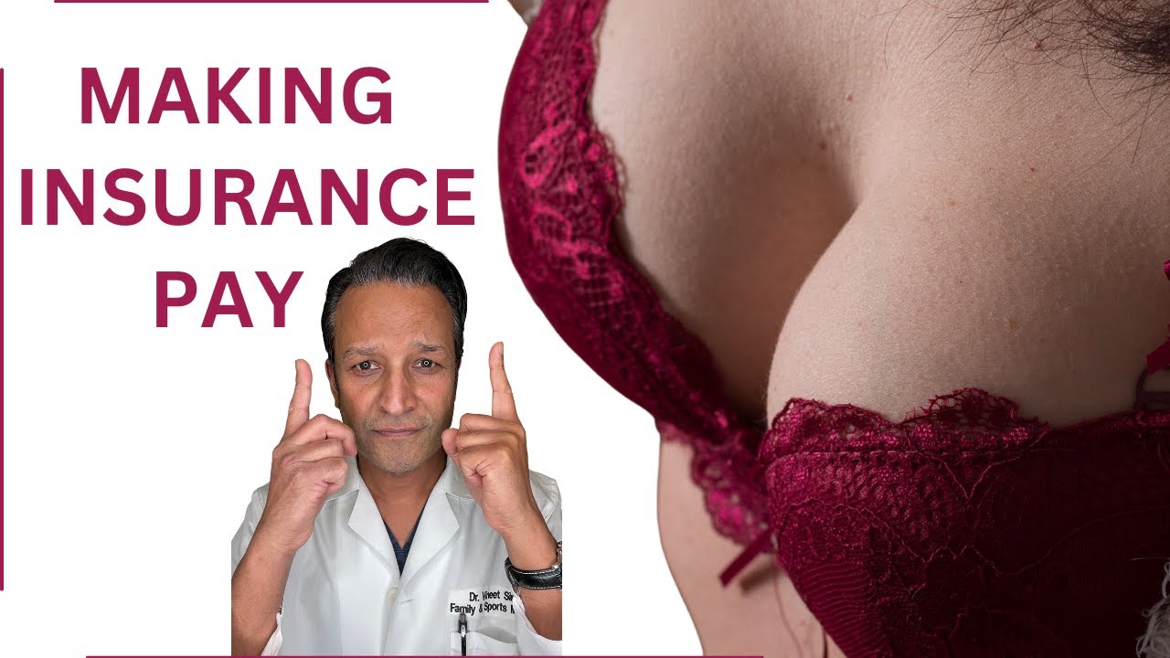 BREAST REDUCTION: How to GET INSURANCE to PAY FOR IT!