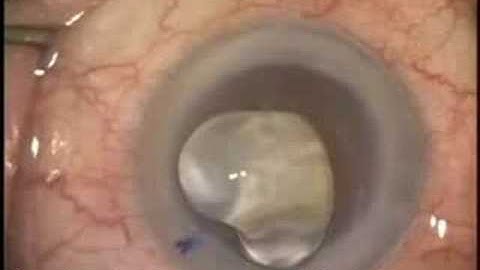 Comparing Cohesive and Dispersive Viscoelastics