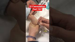 Baby IV Cannulation Part 167 | Baby Cannula Success On First Try 💯 #shorts #viral #hospital #baby