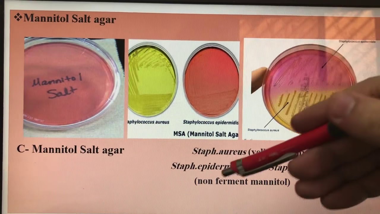 Staphylococci, العملي