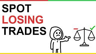 Details The Pre-Trade Checklist That Spots Losing Trades Guide