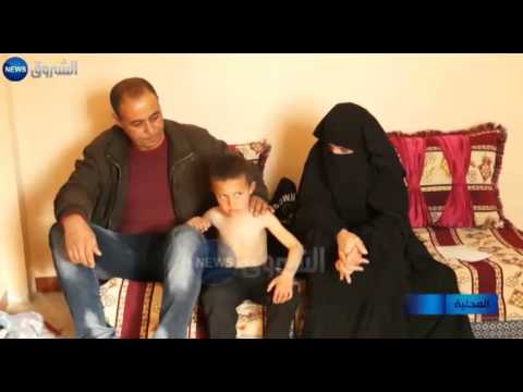 المسيلة الإهمال الطبي يحول حياة الطفل فؤاد إلى جحيم