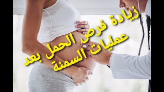 الاسبوع 13 - عمليات السمنة و زيادة فرص  الحمل مع تكيس المبايض