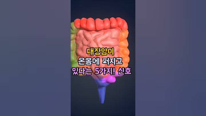 대장암이 온몸에 퍼지고 있다는 5가지 신호! #대장암증상 #암전이신호 #건강경고 #암예방 #대장암초기증상  #건강톡톡스