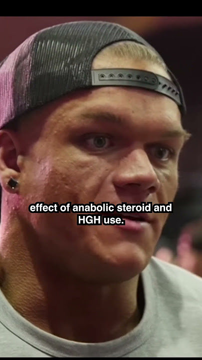 Dallas McCarver Death Revealed!