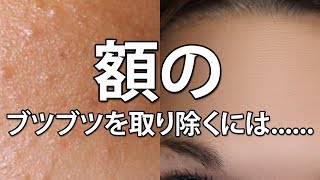 世界の国々で行われているスキンケア３０