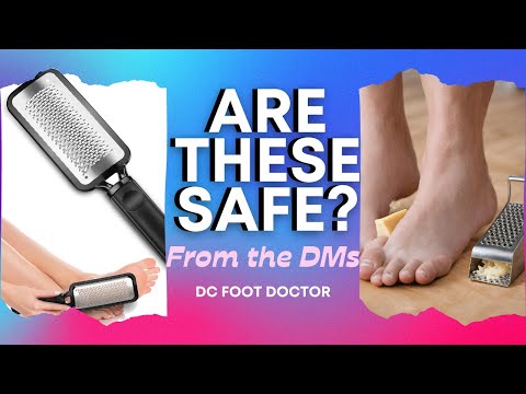 Using Cheese grater or callus shaver can do serious damage, not to
