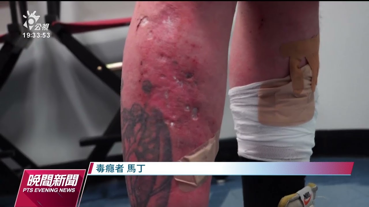 藥物摻入強效毒品及動物鎮定劑 美藥物過量致死創新高｜20230620 公視晚間新聞