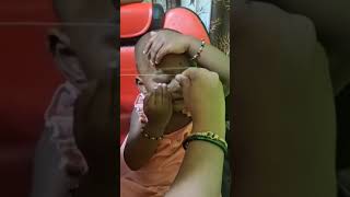 Kaş Nasıl Alınır