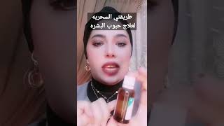 طريقتي السحريه لعلاج حبوب البشره