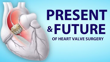 Patient Webinar: The Present and Future of Heart Valve Surgery
