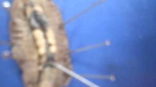 earthworm dissection 4 (12).AVI