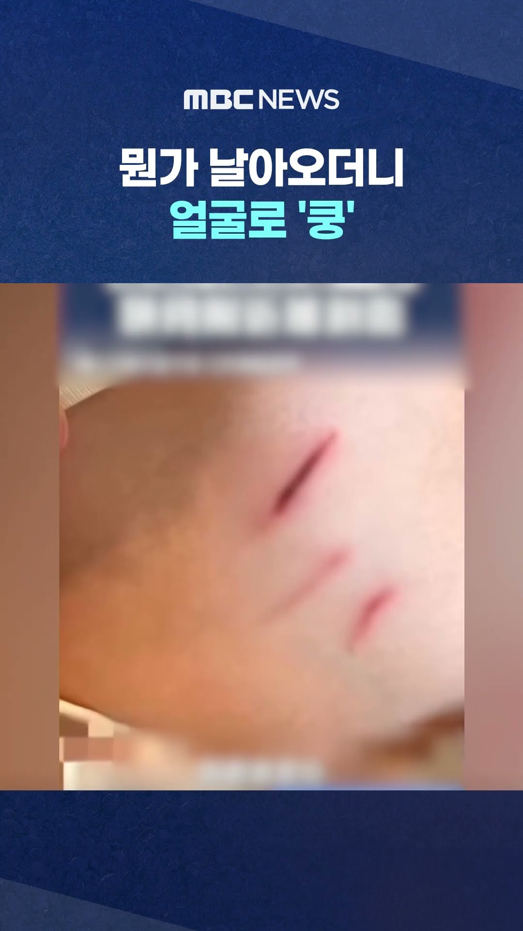 뭔가 날아오더니 얼굴로 '쿵' #Shorts (MBC뉴스)