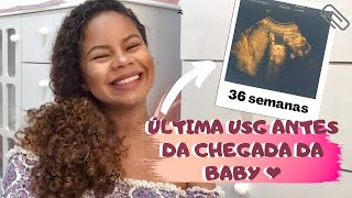 DIÁRIO DE GRAVIDEZ - 36 SEMANAS - Vimos a baby pelo ultrassom | ABEBELLA