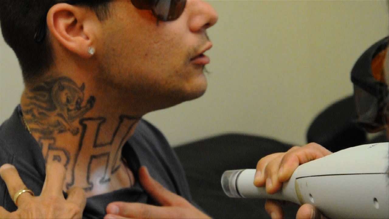 Gang-related tattoo removal at Homeboy Industries - YouTube