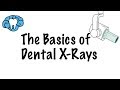 How to Read Dental X-Rays
