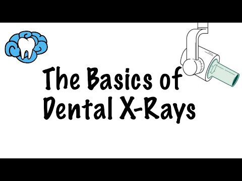 How to Read Dental X-Rays