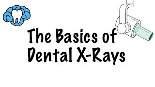 How to Read Dental XRays