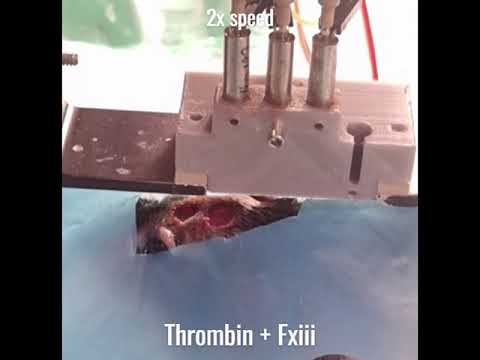 Printing new skin layers directly onto a wound